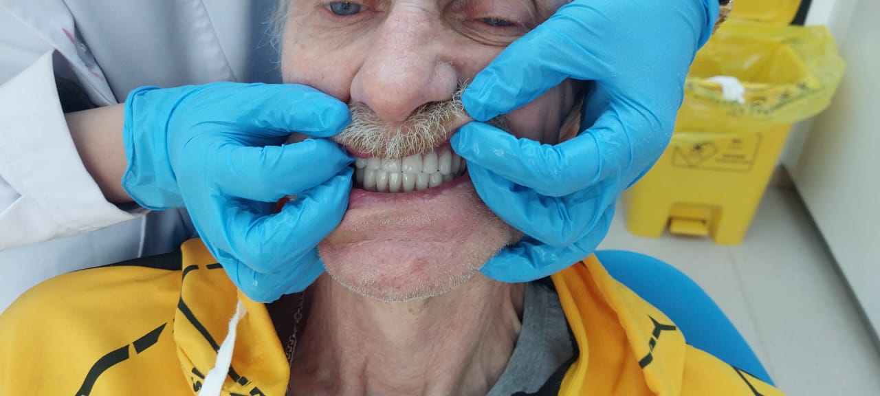 после протезирования зубов в Китае