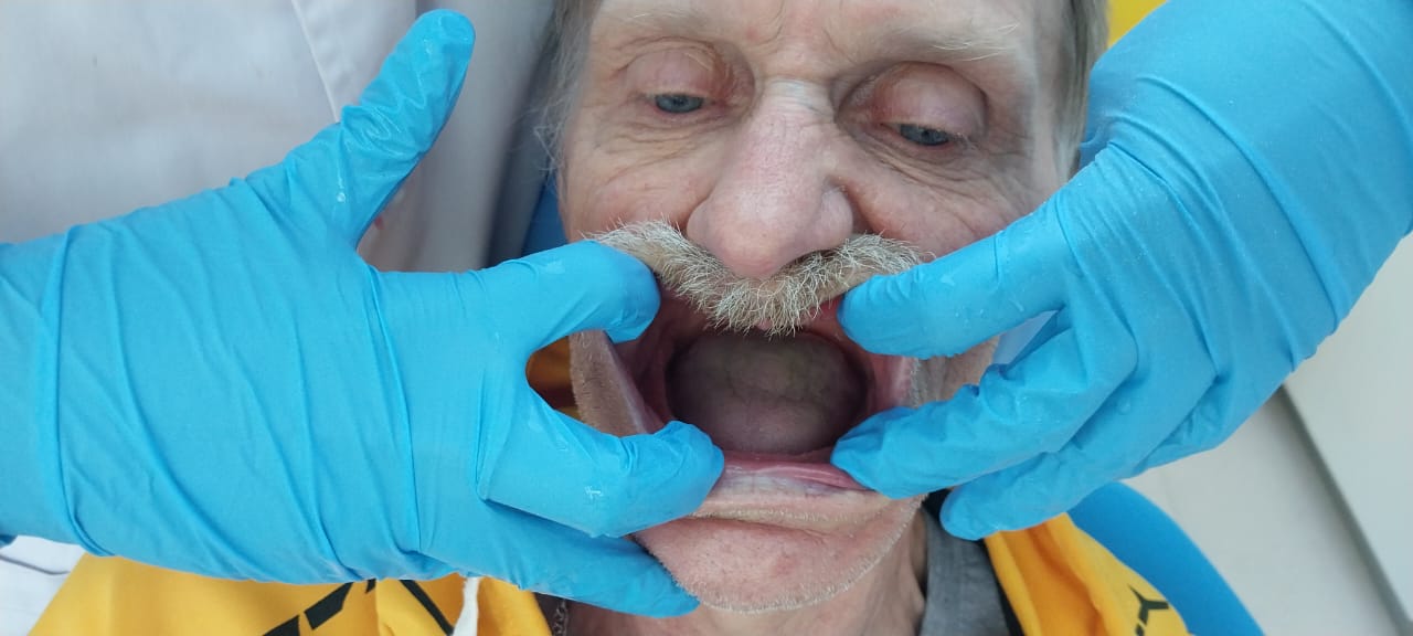 до протезировании зубов в Китае