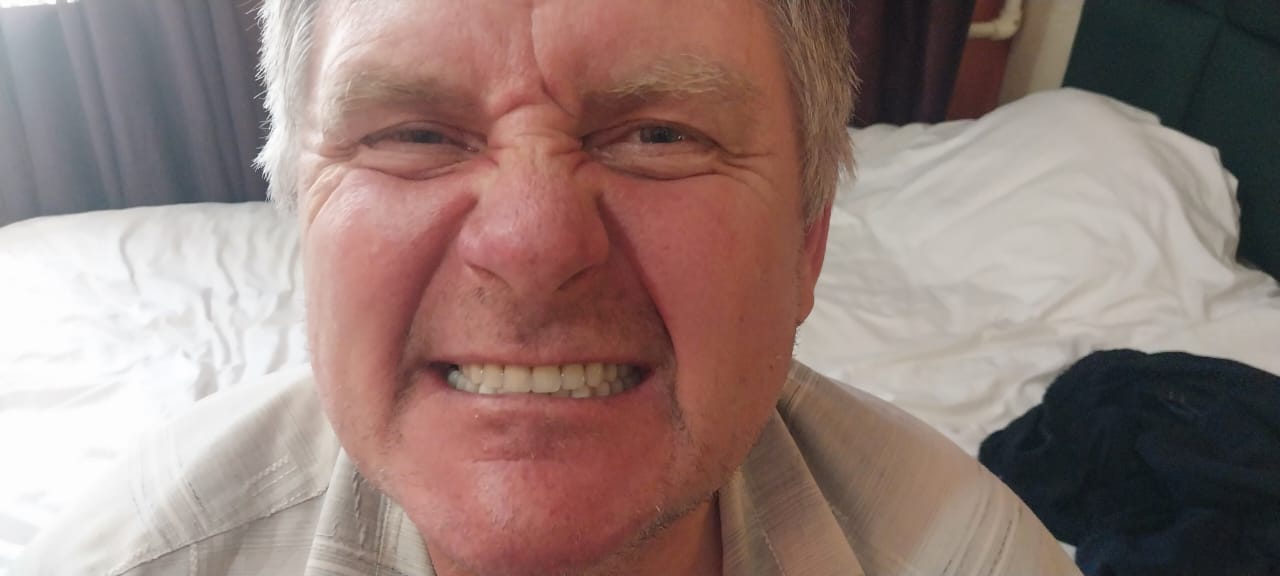 после протезирования зубов в Китае